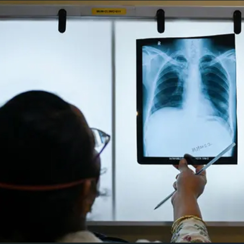 वडाबाटै एक्स–रे सेवा एक सय ५० रुपैयाँमा