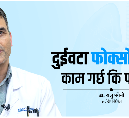 कसरी काम गर्छ – फोक्सोको वृत्तान्त, यो कस्तो हुन्छ ?